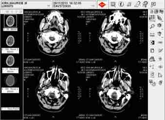 14 01 23 Bautiful Brain