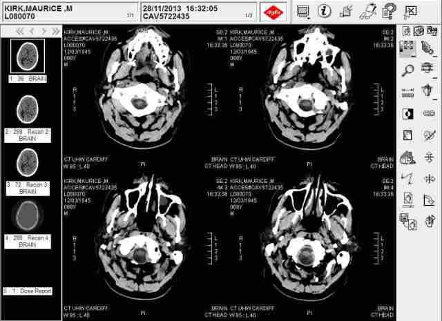 14 01 23 Bautiful Brain
